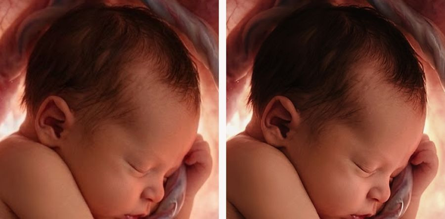 Comparação do rosto antes e depois do upscale