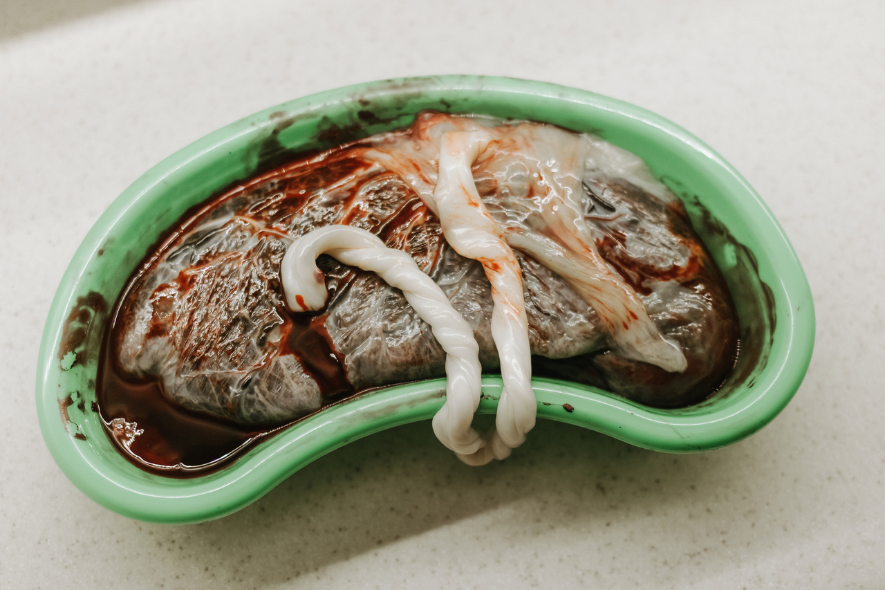 registro da placenta árvore da vida após o parto domiciliar