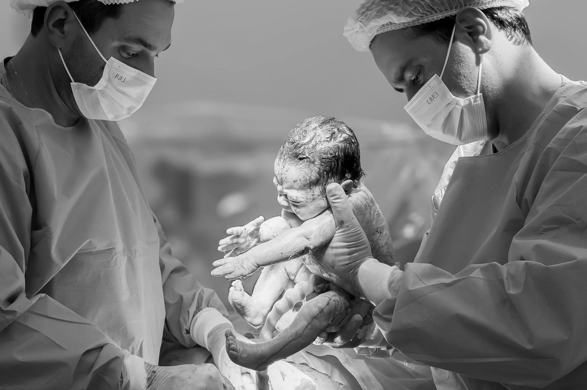 fotografia de um bebe nascendo nas maos do medico em São Paulo