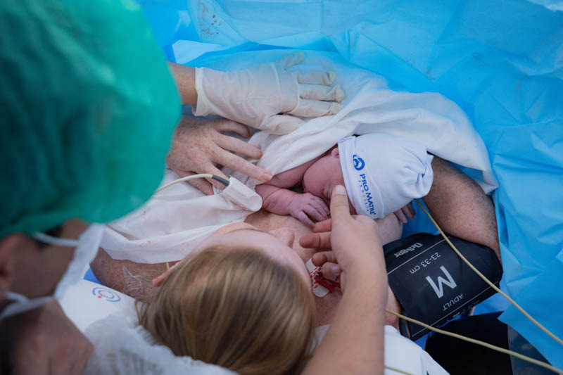 Imagens de parto normal