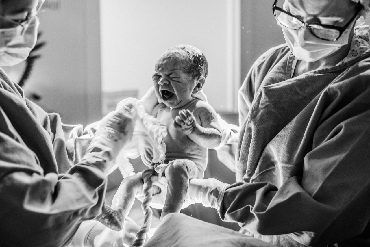 fotografia de parto bebê saindo da barriga sendo segurado pro duas medicas