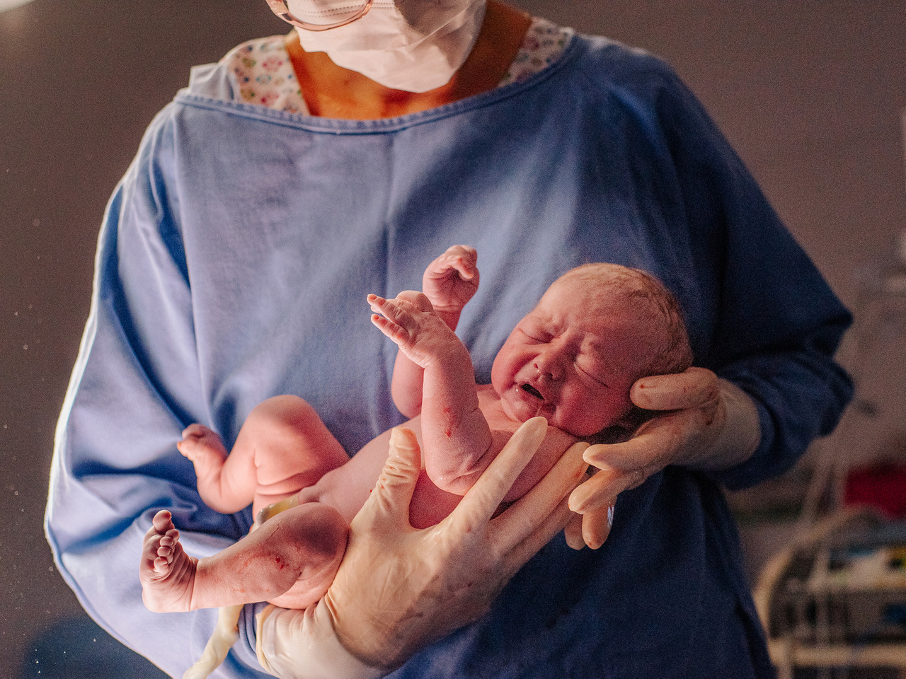 Recém-nascido sendo amparado pela equipe médica logo após o nascimento em sala cirúrgica, fotografia de parto documental registrando os primeiros instantes de vida com cuidado e técnica