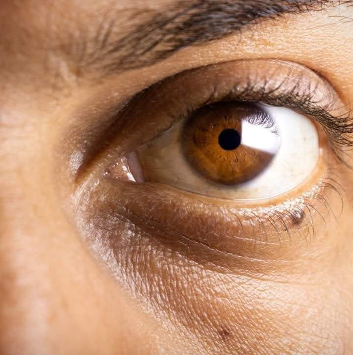 Imagem em formato quadrático representando um olho humano de cor castanho claro em close-up.