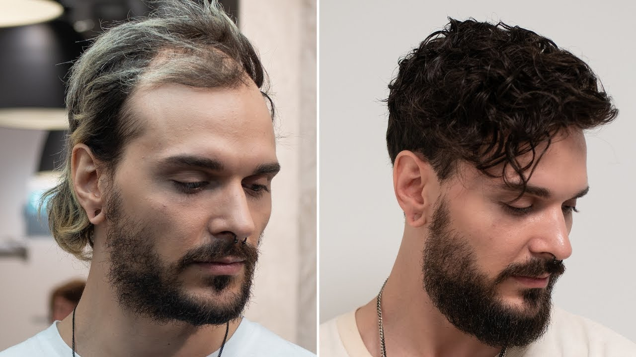 Best hair system for men