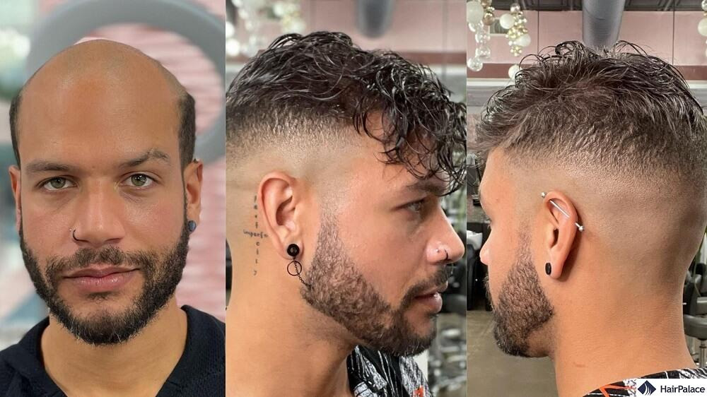 Hair pieces for men 